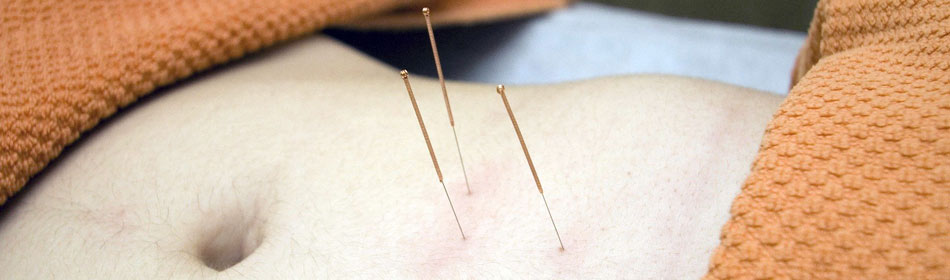 Accupuncture, Eastern Healing Arts in the Chalfont, Bucks County PA area